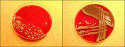 Bacteria Growth